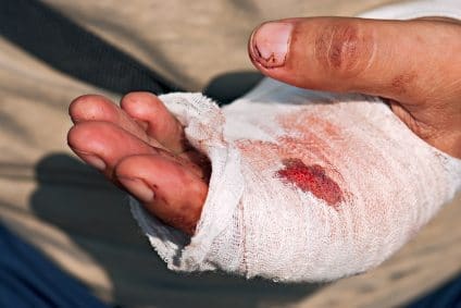 Medicine bandage on human injury hand after accident with chains