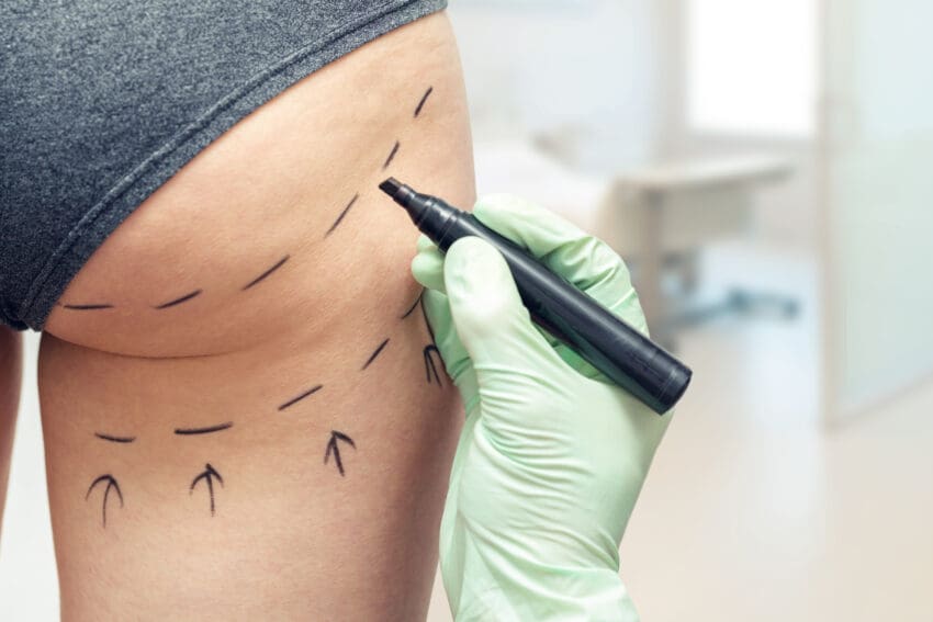 New curbs on cosmetic surgery ads